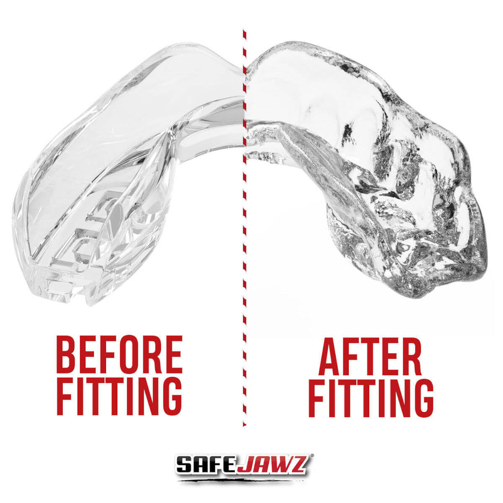 SafeJawz "Intro" mouthguard